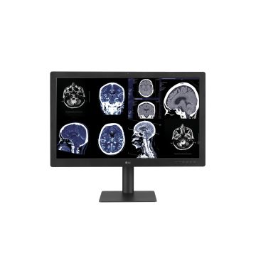 Νέα διαγνωστική οθόνη της LG με τεχνολογία IPS Black